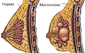 Классификация