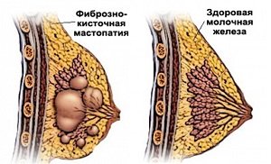 О заболевании