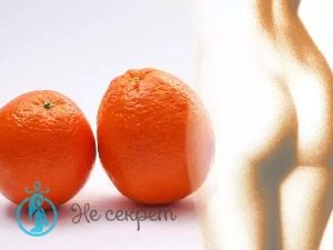 Мезотерапия тела при целлюлите