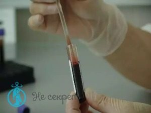 Что такое плазмолифитинг лица