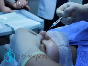 Радикальные способы удаления межбровной морщины