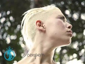 Причина образования морщин на шее и в зоне декольте